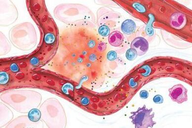 Wirkung von Boswellia auf entzündete Körperstellen.